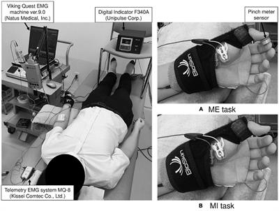 Thenar Muscle Motor Imagery Increases <mark class="highlighted">Spinal Motor Neuron</mark> Excitability of the Abductor Digiti Minimi Muscle